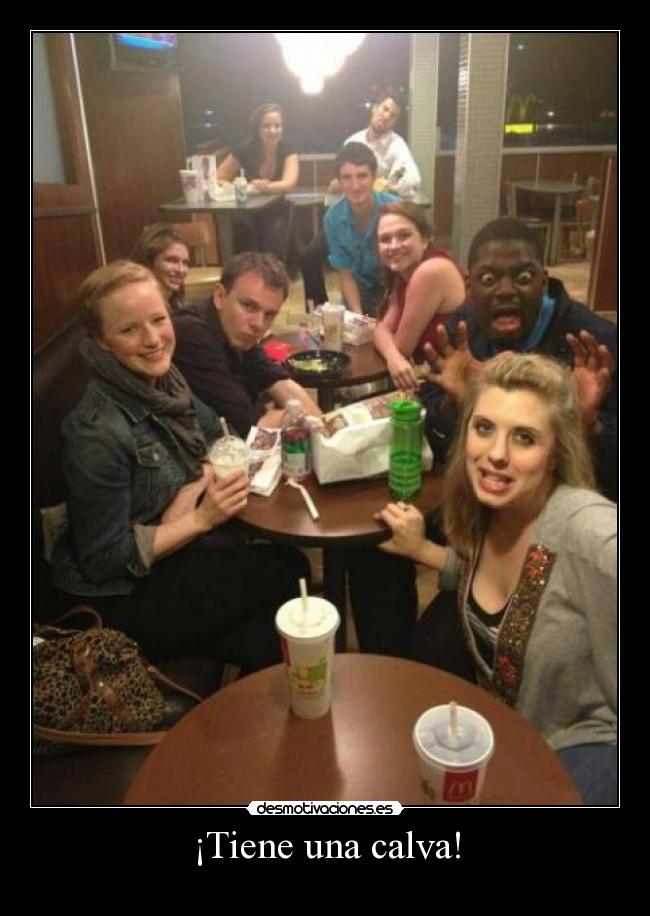 ¡Tiene una calva! -