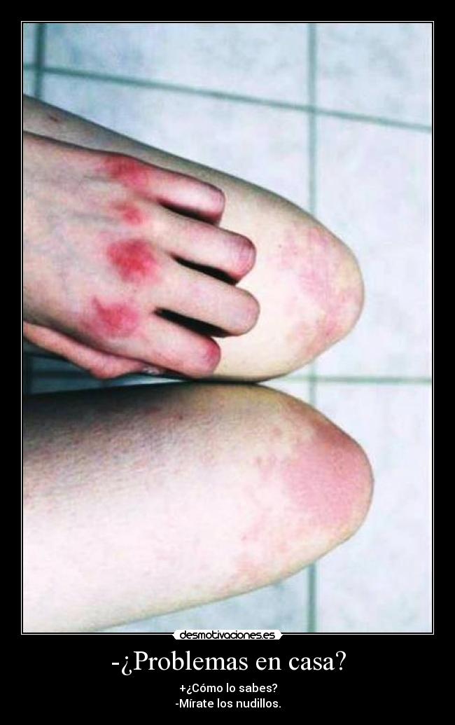-¿Problemas en casa? -