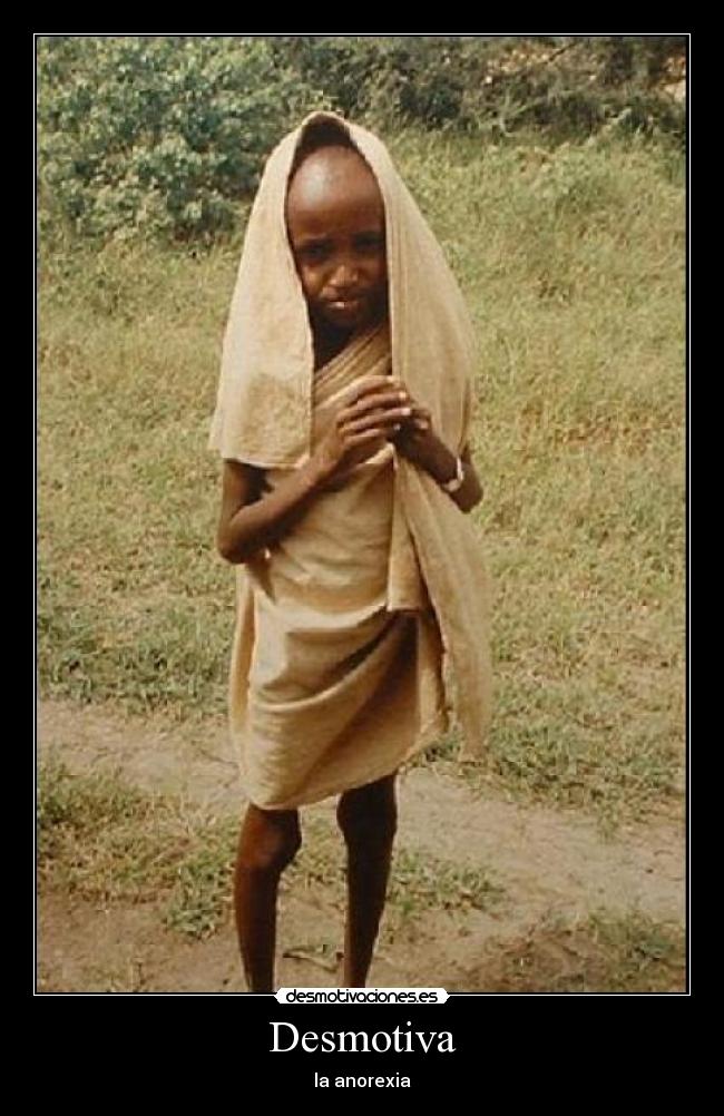 Desmotiva - la anorexia
