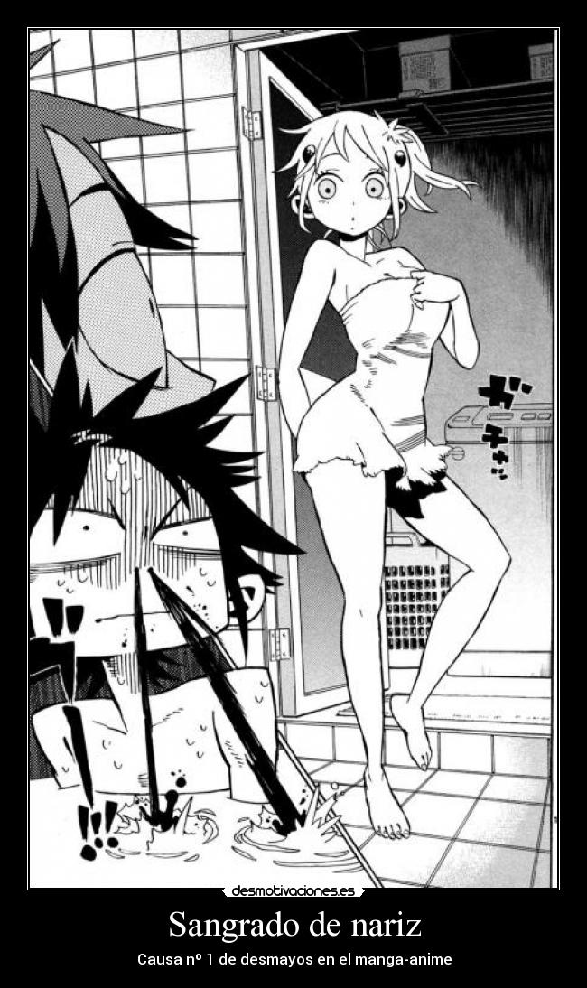 Sangrado de nariz - 