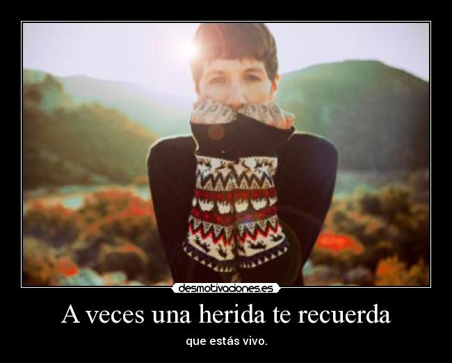 A veces una herida te recuerda -