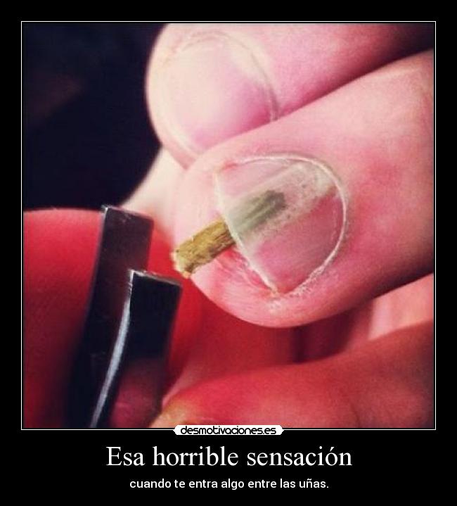 Esa horrible sensación -