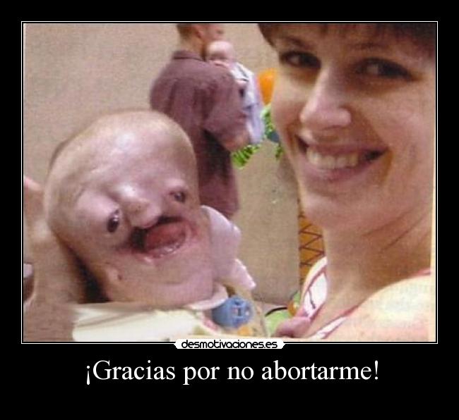 ¡Gracias por no abortarme! -