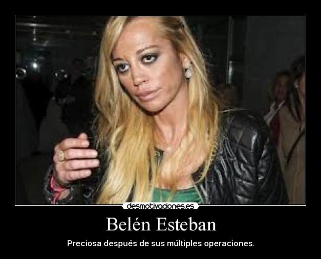 Belén Esteban - Preciosa después de sus múltiples operaciones.