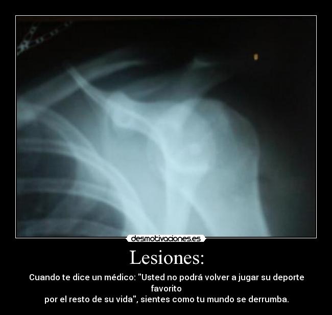 Lesiones: - Cuando te dice un médico: Usted no podrá volver a jugar su deporte favorito
por el resto de su vida, sientes como tu mundo se derrumba.