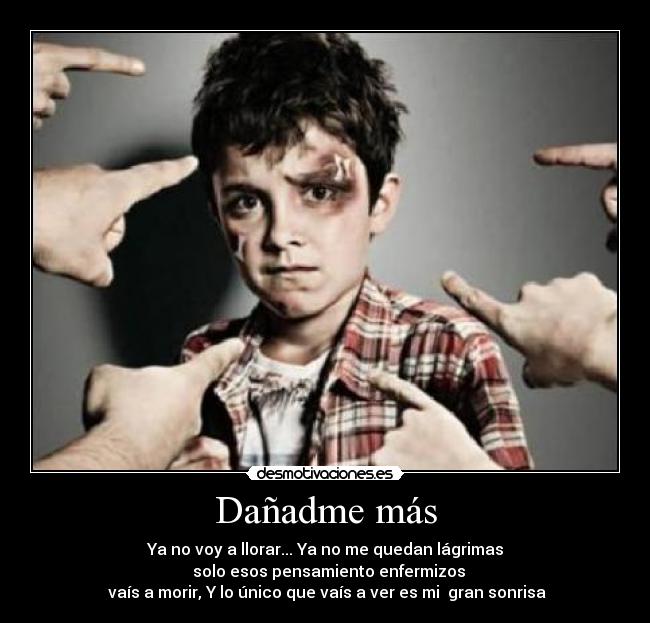 Dañadme más -
