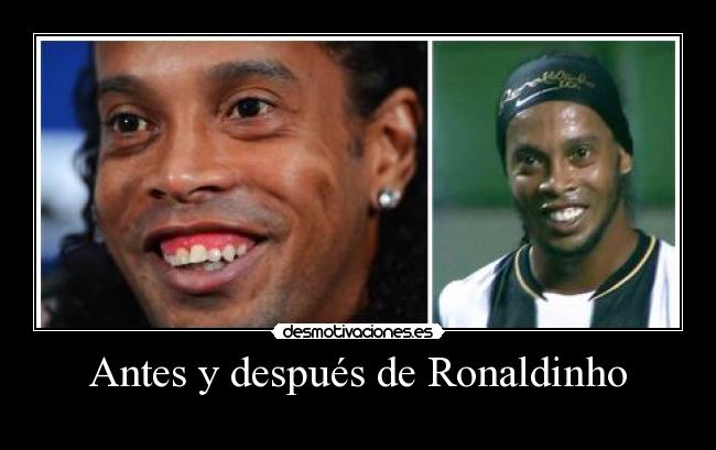 Antes y después de Ronaldinho - 