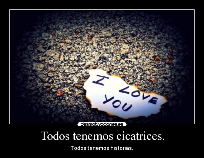 Todos tenemos cicatrices. - Todos tenemos historias.