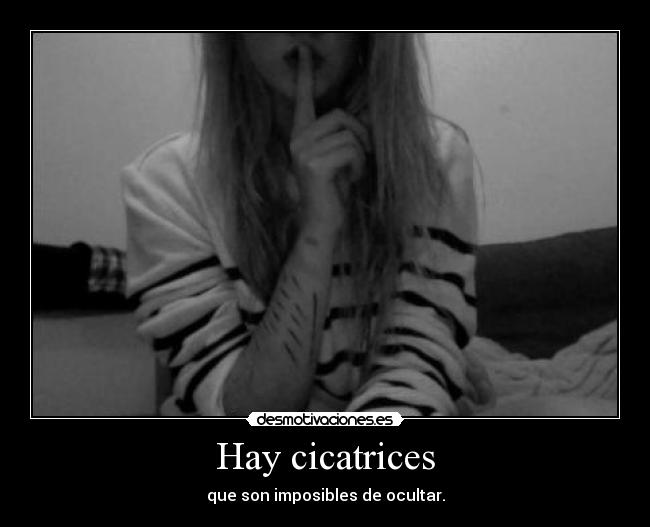 Hay cicatrices - 