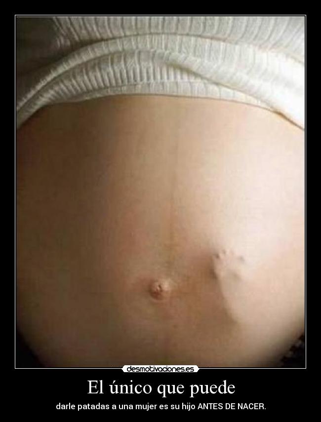 El único que puede -