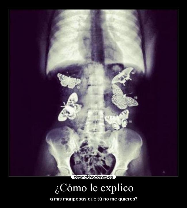 ¿Cómo le explico - a mis mariposas que tú no me quieres?