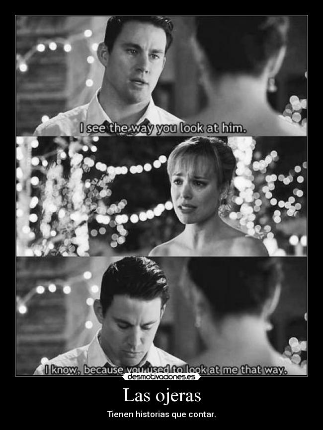 Las ojeras - Tienen historias que contar.