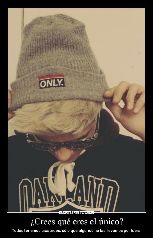 ¿Crees qué eres el único? - 