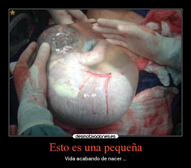 Esto es una pequeña - Vida acabando de nacer ...