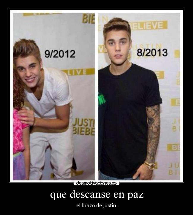 que descanse en paz - el brazo de justin.