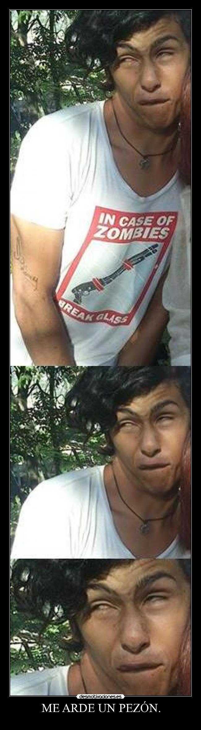 ME ARDE UN PEZÓN. - 