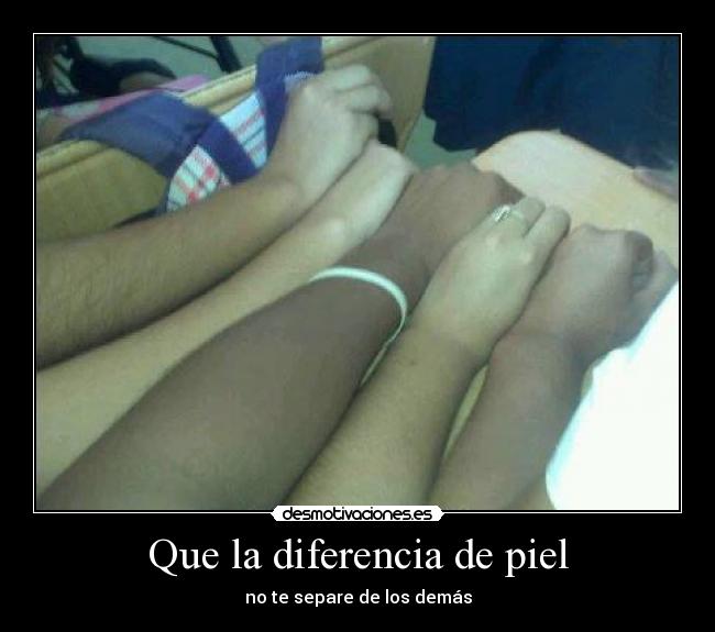 Que la diferencia de piel - 
