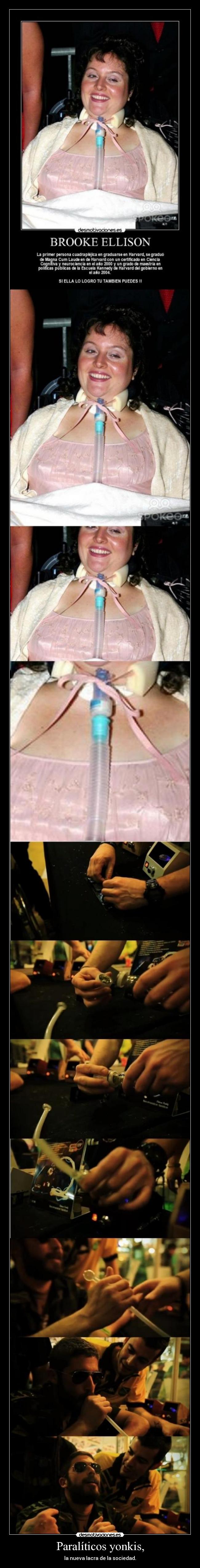 Paralíticos yonkis, - 