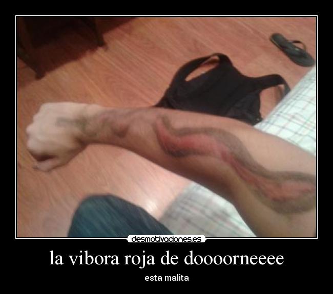 la vibora roja de doooorneeee - 