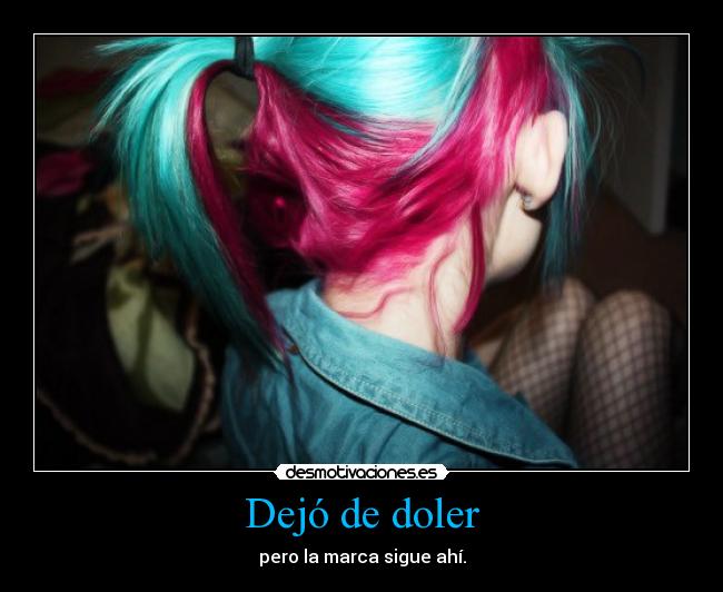 Dejó de doler - 