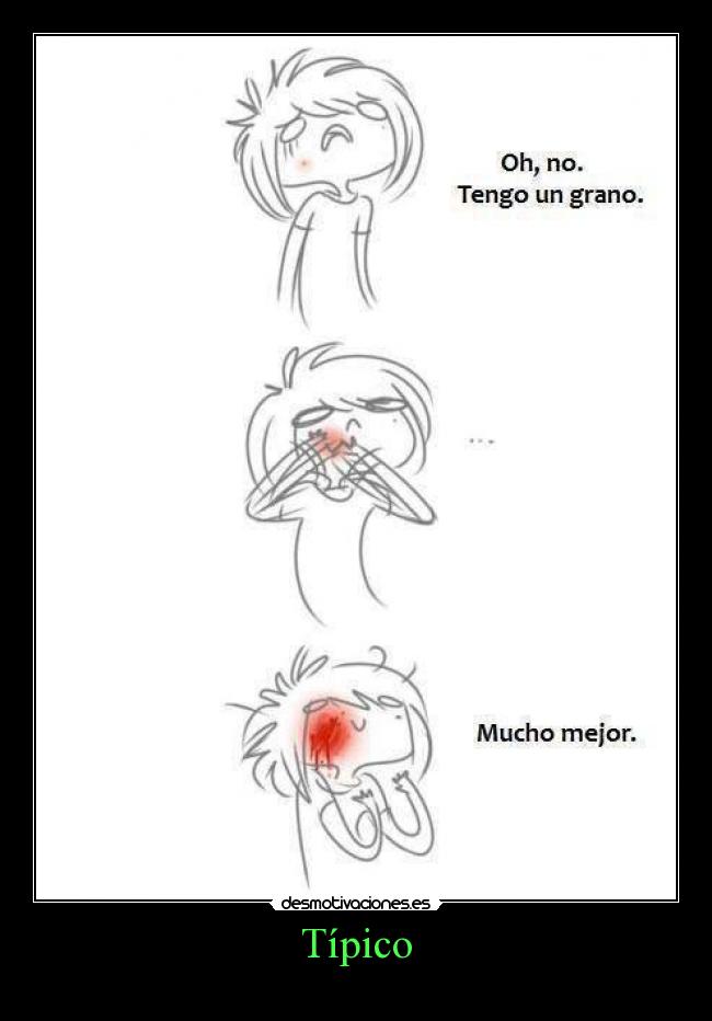 Típico - 