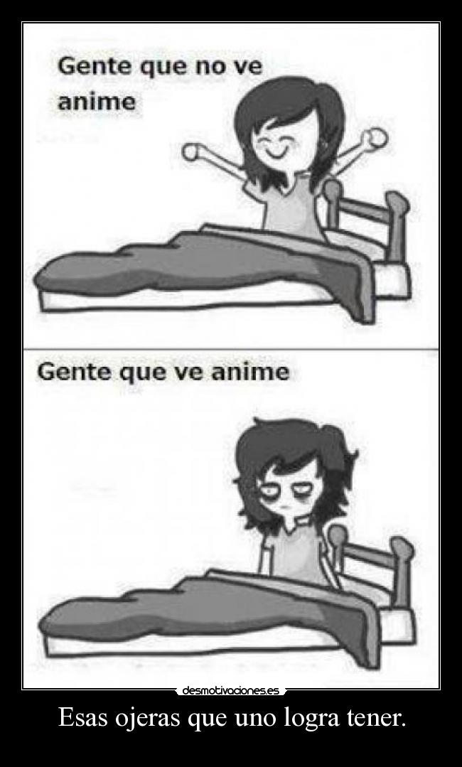 Esas ojeras que uno logra tener. - 