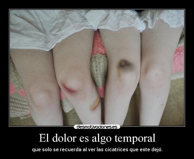 El dolor es algo temporal - que solo se recuerda al ver las cicatrices que este dejó.