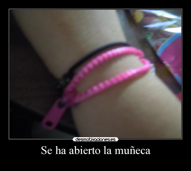 Se ha abierto la muñeca -