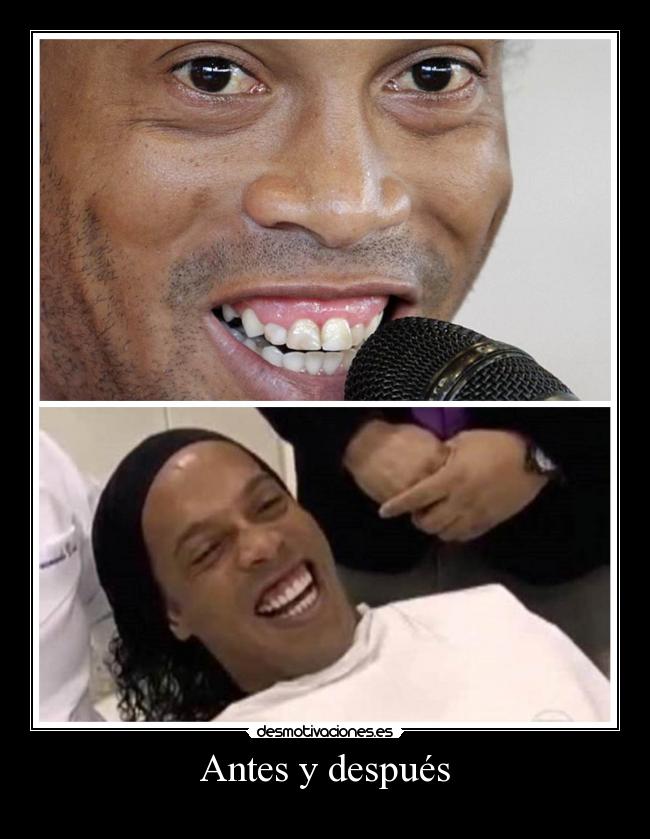 Antes y después - 