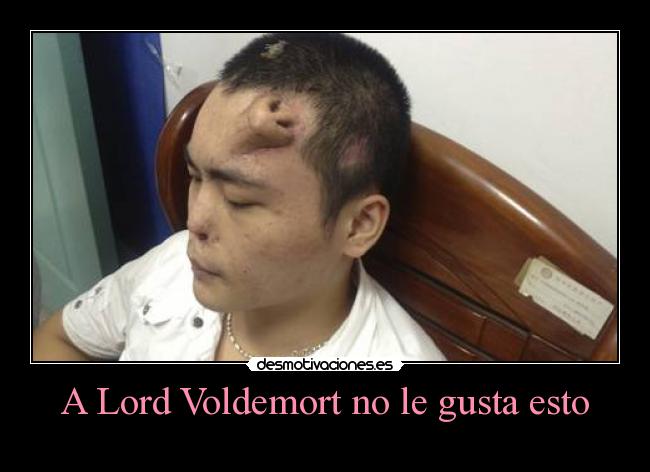 A Lord Voldemort no le gusta esto -