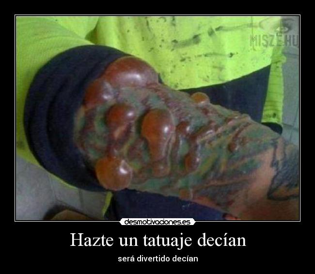 Hazte un tatuaje decían - será divertido decían