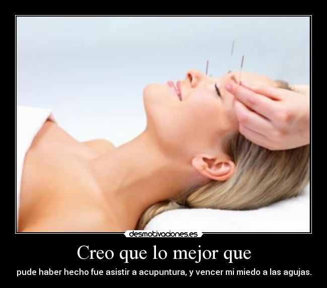 Creo que lo mejor que - pude haber hecho fue asistir a acupuntura, y vencer mi miedo a las agujas.