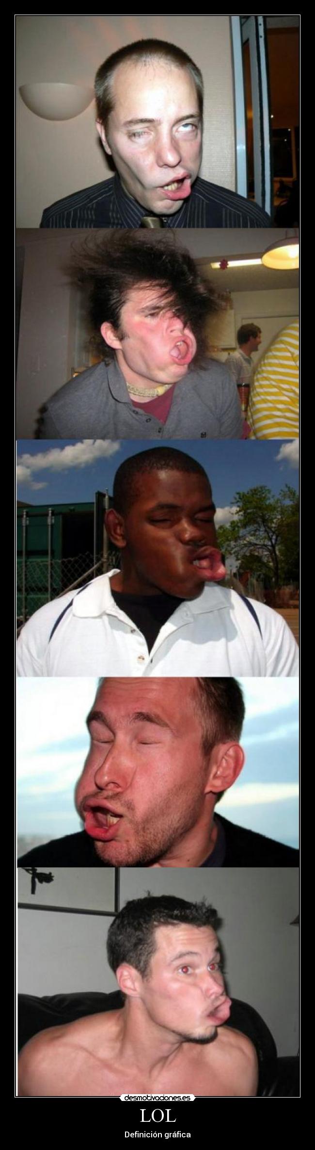 LOL - Definición gráfica