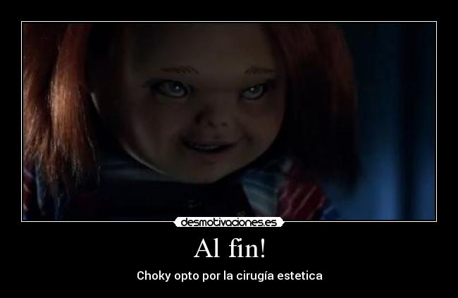 Al fin! - Choky opto por la cirugía estetica