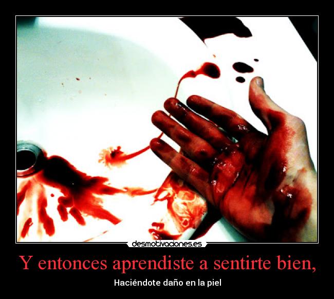 Y entonces aprendiste a sentirte bien, - Haciéndote daño en la piel