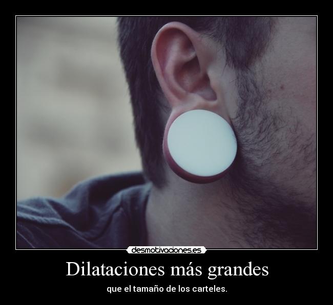 Dilataciones más grandes - 