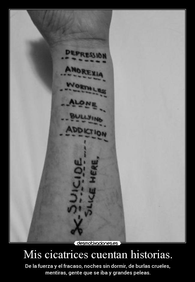 Mis cicatrices cuentan historias. - De la fuerza y el fracaso, noches sin dormir, de burlas crueles,
mentiras, gente que se iba y grandes peleas.