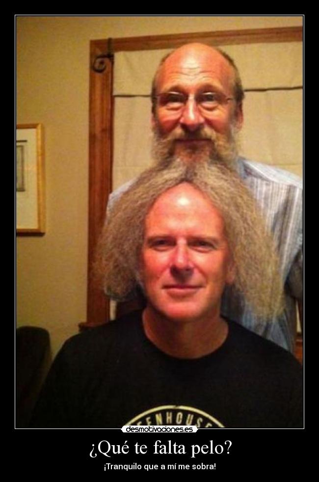 ¿Qué te falta pelo? -