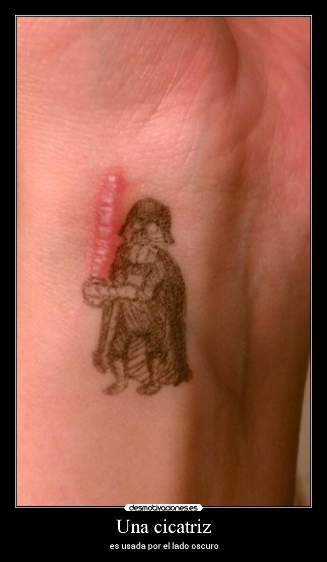 Una cicatriz - 