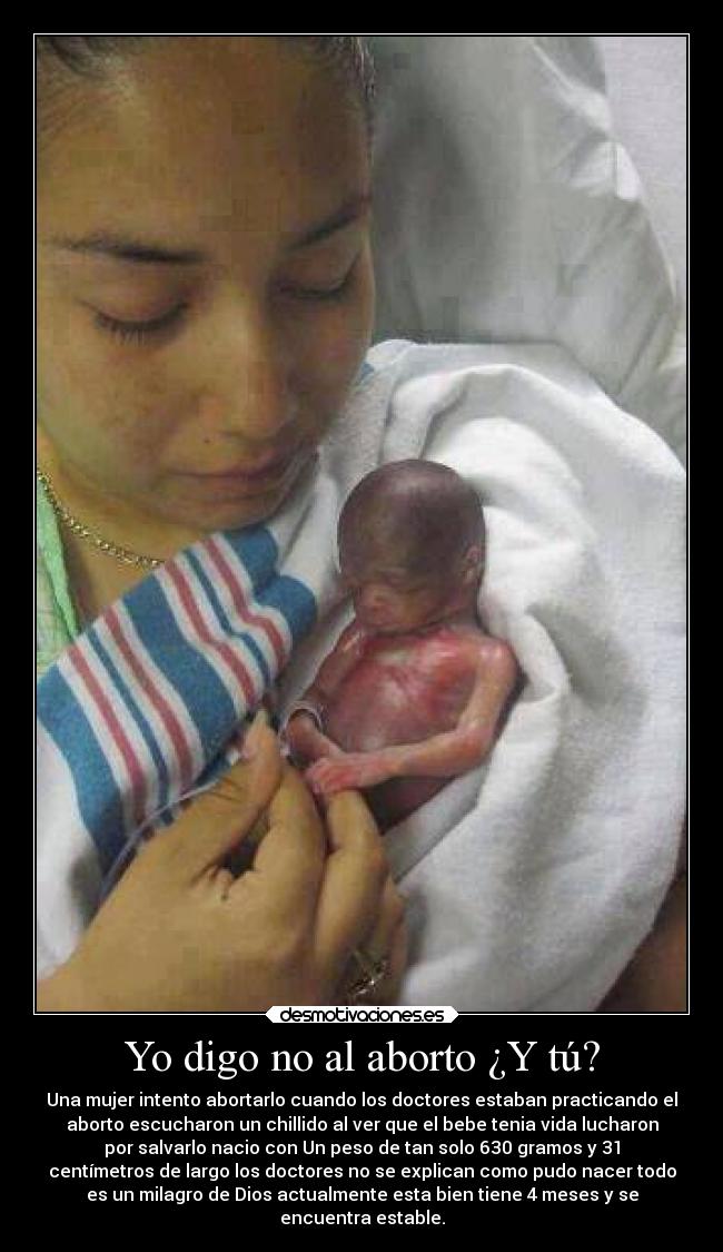 Yo digo no al aborto ¿Y tú? - Una mujer intento abortarlo cuando los doctores estaban practicando el
aborto escucharon un chillido al ver que el bebe tenia vida lucharon
por salvarlo nacio con Un peso de tan solo 630 gramos y 31
centímetros de largo los doctores no se explican como pudo nacer todo
es un milagro de Dios actualmente esta bien tiene 4 meses y se
encuentra estable.