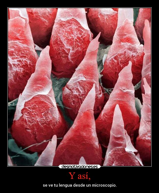 Y así, - se ve tu lengua desde un microscopio.