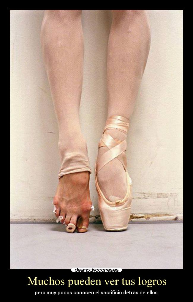 Muchos pueden ver tus logros - pero muy pocos conocen el sacrificio detrás de ellos.