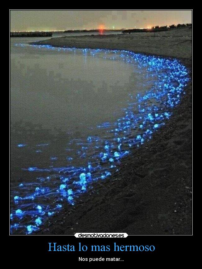 Hasta lo mas hermoso - Nos puede matar...