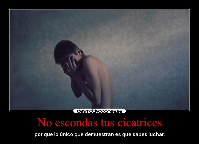 No escondas tus cicatrices - por que lo único que demuestran es que sabes luchar.