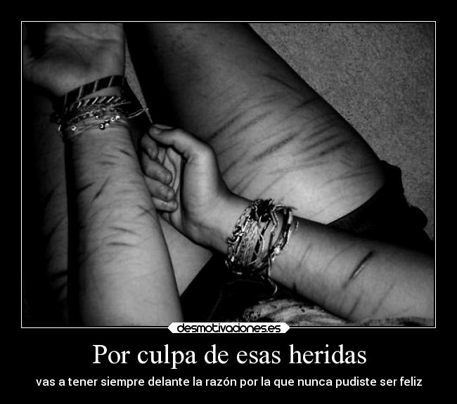 Por culpa de esas heridas -