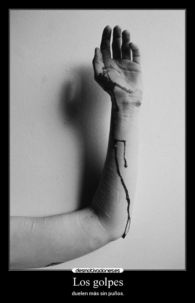 Los golpes - 