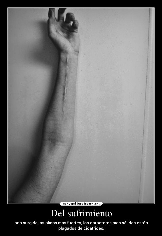 Del sufrimiento - han surgido las almas mas fuertes, los caracteres mas sólidos están
plagados de cicatrices.