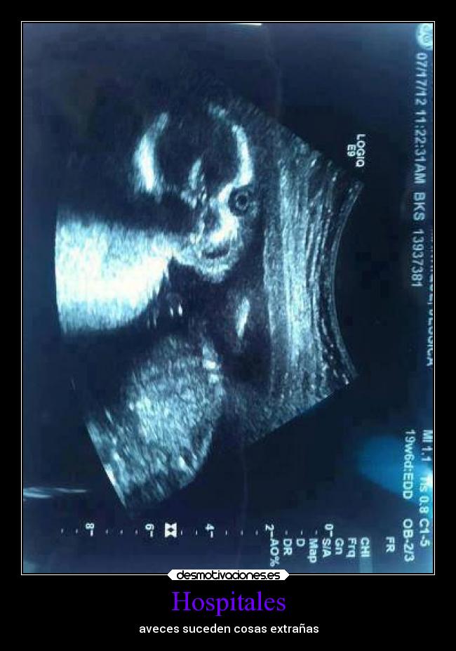 Hospitales - aveces suceden cosas extrañas
