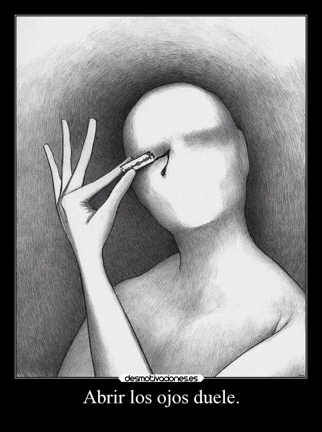 Abrir los ojos duele. -