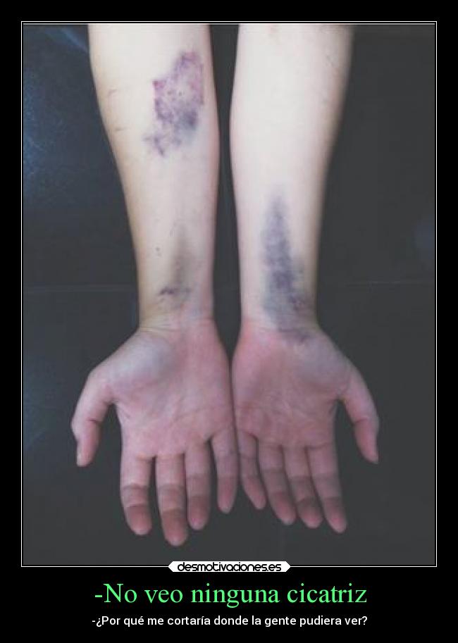 -No veo ninguna cicatriz -